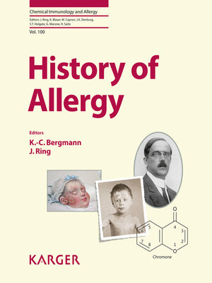 cover image of History of Allergy